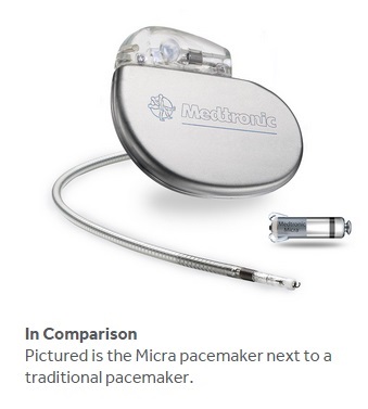 Pacemaker comparison