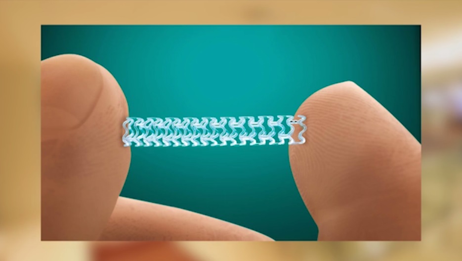 Absorbable-Stent-final900