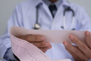 ekg