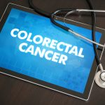 colorectal cancer treatment